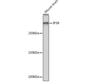 Western Blot - Anti-IP3 receptor Antibody [ARC1007] (A306244) - Antibodies.com