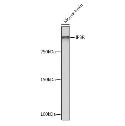 Western Blot - Anti-IP3 receptor Antibody [ARC1007] (A306244) - Antibodies.com