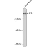 Western Blot - Anti-IP3 receptor Antibody [ARC1007] (A306244) - Antibodies.com