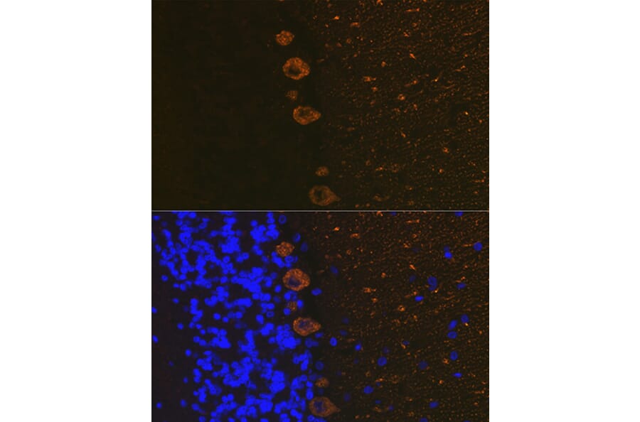 Immunofluorescence - Anti-IP3 receptor Antibody [ARC1007] (A306244) - Antibodies.com