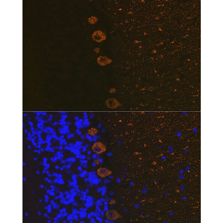 Immunofluorescence - Anti-IP3 receptor Antibody [ARC1007] (A306244) - Antibodies.com