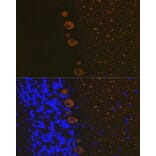 Immunofluorescence - Anti-IP3 receptor Antibody [ARC1007] (A306244) - Antibodies.com
