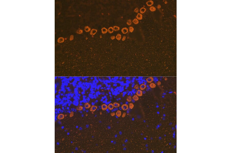 Immunofluorescence - Anti-IP3 receptor Antibody [ARC1007] (A306244) - Antibodies.com