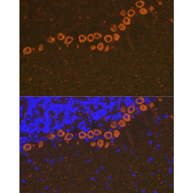 Immunofluorescence - Anti-IP3 receptor Antibody [ARC1007] (A306244) - Antibodies.com