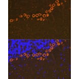 Immunofluorescence - Anti-IP3 receptor Antibody [ARC1007] (A306244) - Antibodies.com