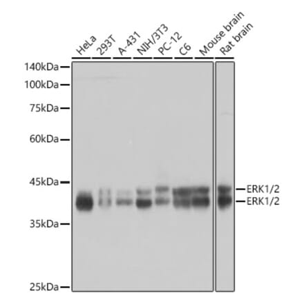 Western Blot - Anti-ERK1 + ERK2 Antibody [ARC0212] (A306245) - Antibodies.com