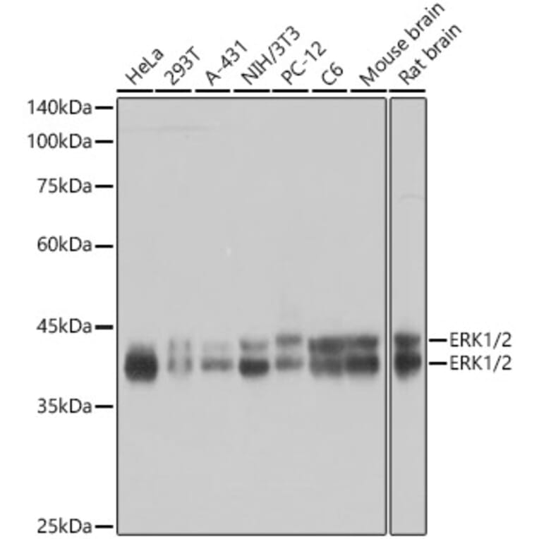 Western Blot - Anti-ERK1 + ERK2 Antibody [ARC0212] (A306245) - Antibodies.com