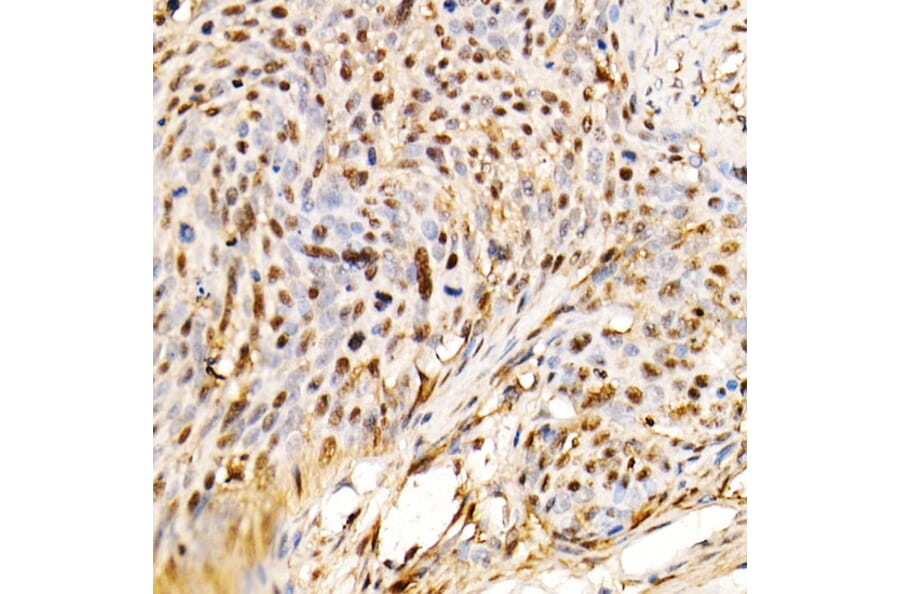 Immunohistochemistry - Anti-ERK1 + ERK2 Antibody [ARC0212] (A306245) - Antibodies.com