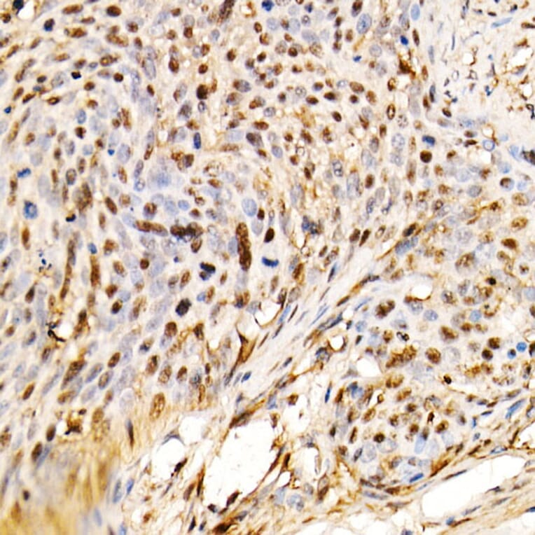 Immunohistochemistry - Anti-ERK1 + ERK2 Antibody [ARC0212] (A306245) - Antibodies.com