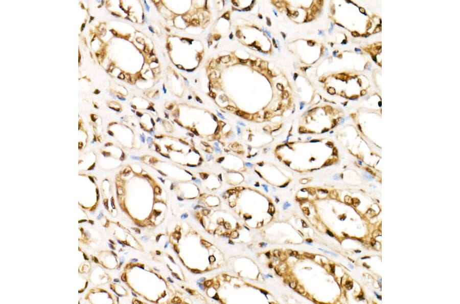 Immunohistochemistry - Anti-ERK1 + ERK2 Antibody [ARC0212] (A306245) - Antibodies.com