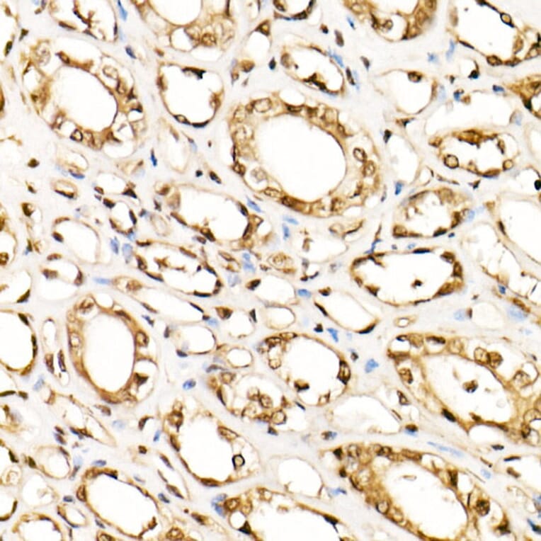 Immunohistochemistry - Anti-ERK1 + ERK2 Antibody [ARC0212] (A306245) - Antibodies.com