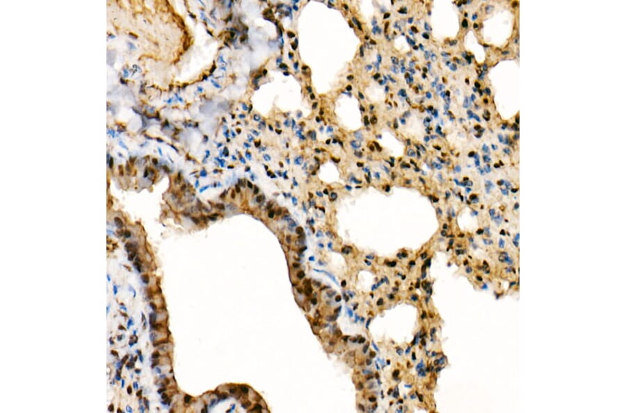 Immunohistochemistry - Anti-ERK1 + ERK2 Antibody [ARC0212] (A306245) - Antibodies.com