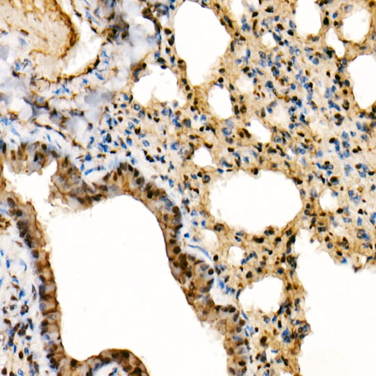 Immunohistochemistry - Anti-ERK1 + ERK2 Antibody [ARC0212] (A306245) - Antibodies.com