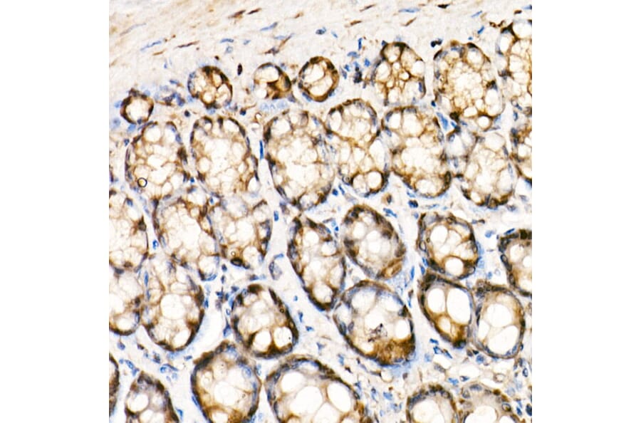 Immunohistochemistry - Anti-ERK1 + ERK2 Antibody [ARC0212] (A306245) - Antibodies.com