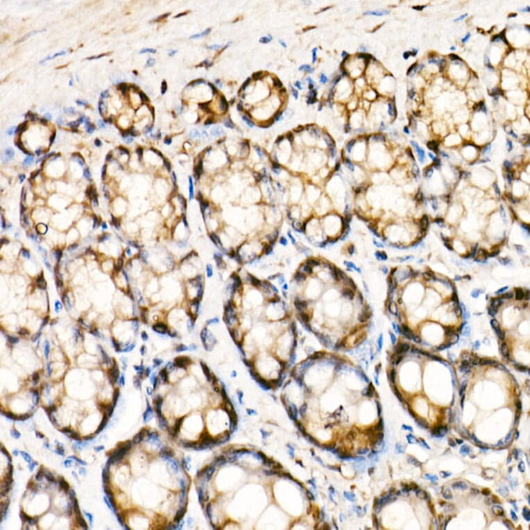Immunohistochemistry - Anti-ERK1 + ERK2 Antibody [ARC0212] (A306245) - Antibodies.com