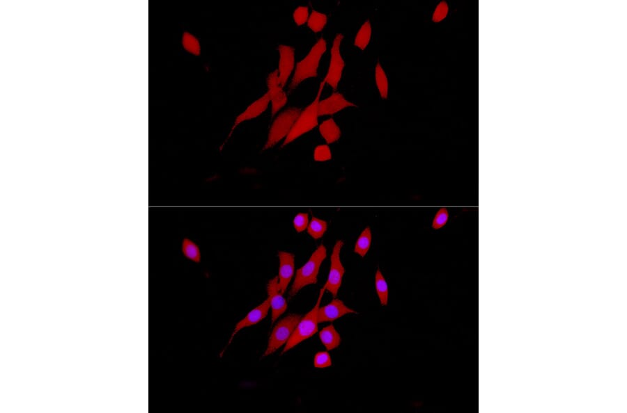 Immunofluorescence - Anti-ERK1 + ERK2 Antibody [ARC0212] (A306245) - Antibodies.com