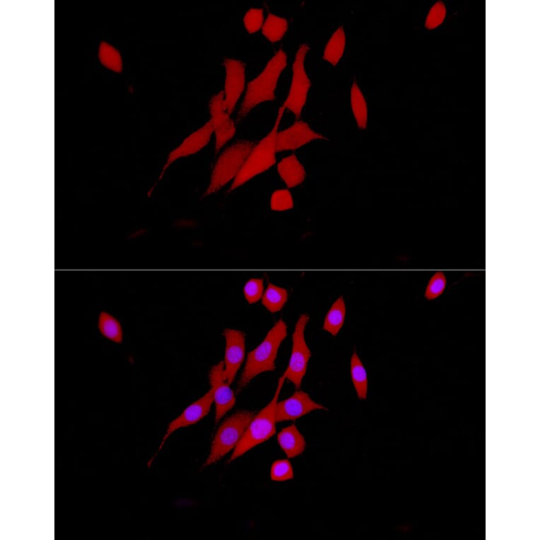 Immunofluorescence - Anti-ERK1 + ERK2 Antibody [ARC0212] (A306245) - Antibodies.com