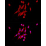 Immunofluorescence - Anti-ERK1 + ERK2 Antibody [ARC0212] (A306245) - Antibodies.com