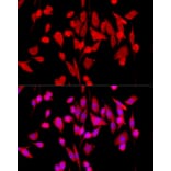 Immunofluorescence - Anti-ERK1 + ERK2 Antibody [ARC0212] (A306245) - Antibodies.com