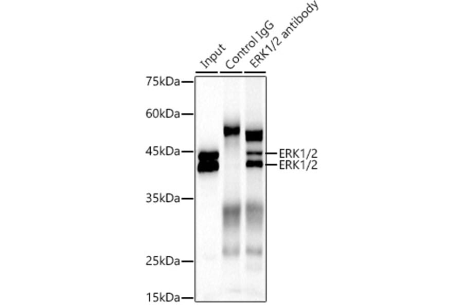 Western Blot - Anti-ERK1 + ERK2 Antibody [ARC0212] (A306245) - Antibodies.com