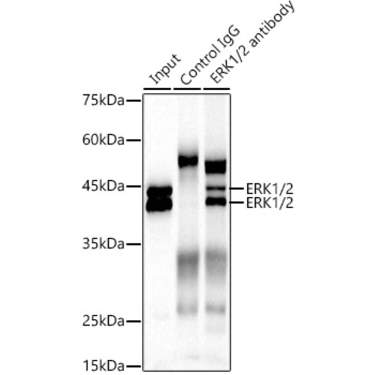 Western Blot - Anti-ERK1 + ERK2 Antibody [ARC0212] (A306245) - Antibodies.com