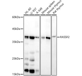 Western Blot - Anti-RASSF2 Antibody [ARC2868] (A306246) - Antibodies.com