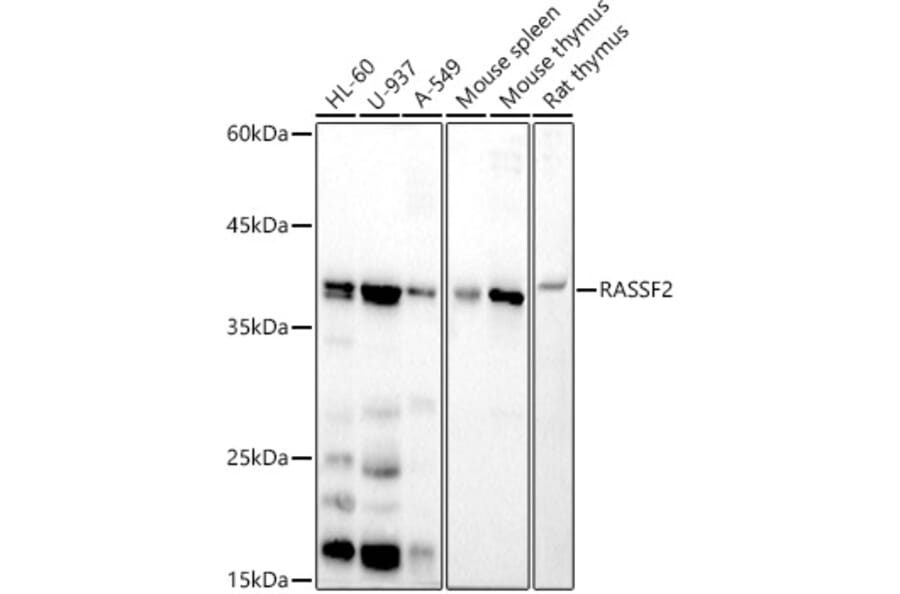Western Blot - Anti-RASSF2 Antibody [ARC2868] (A306246) - Antibodies.com