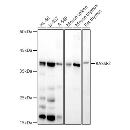 Western Blot - Anti-RASSF2 Antibody [ARC2868] (A306246) - Antibodies.com