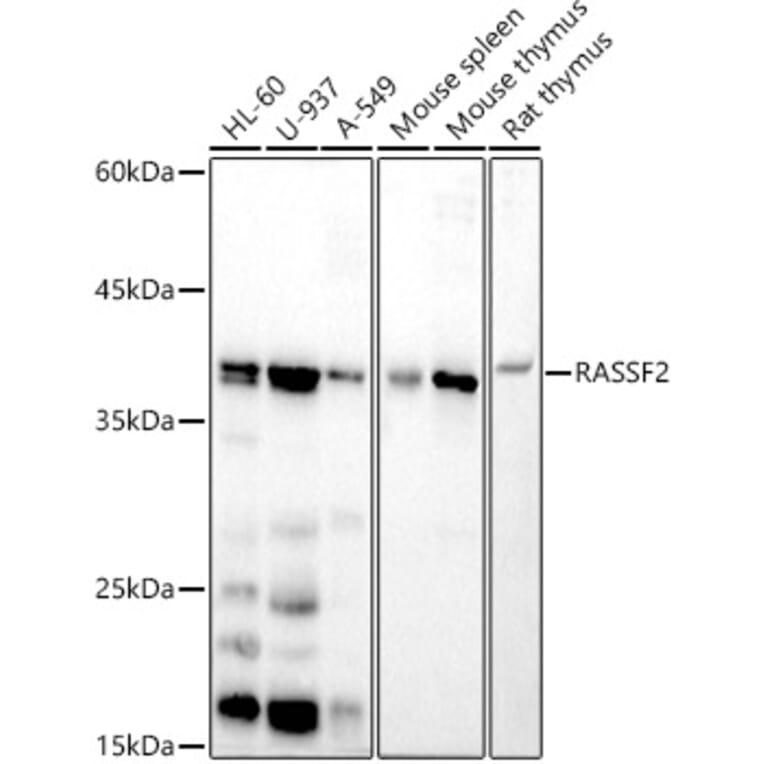 Western Blot - Anti-RASSF2 Antibody [ARC2868] (A306246) - Antibodies.com