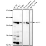 Western Blot - Anti-RASSF2 Antibody [ARC2868] (A306246) - Antibodies.com