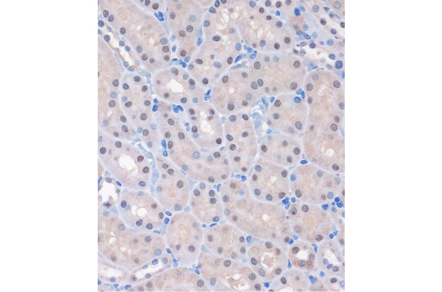 Immunohistochemistry - Anti-MTMR8 Antibody (A306247) - Antibodies.com