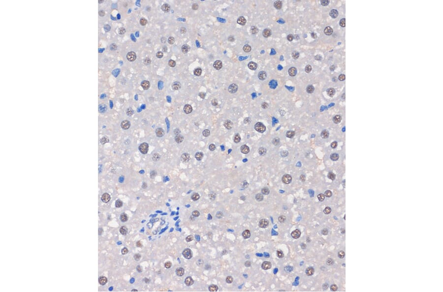 Immunohistochemistry - Anti-MTMR8 Antibody (A306247) - Antibodies.com