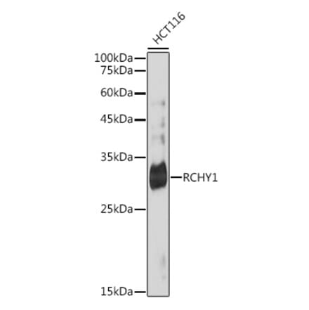 Western Blot - Anti-Pirh2 Antibody [ARC2469] (A306249) - Antibodies.com