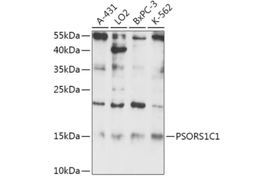 Western Blot - Anti-PSORS1C1 Antibody (A306250) - Antibodies.com