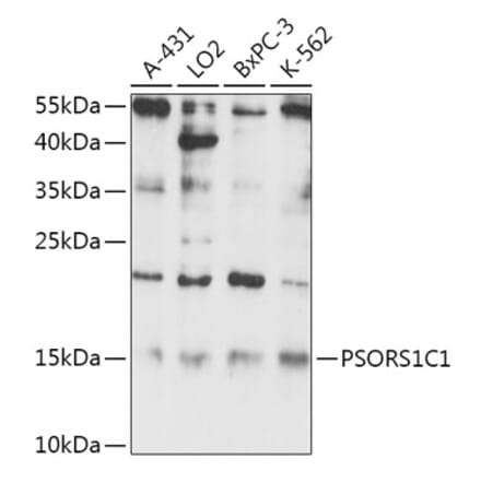 Western Blot - Anti-PSORS1C1 Antibody (A306250) - Antibodies.com