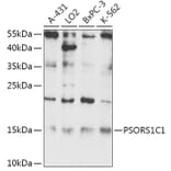 Western Blot - Anti-PSORS1C1 Antibody (A306250) - Antibodies.com