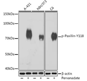 Western Blot - Anti-Paxillin (phospho Tyr118) Antibody [ARC1696] (A306251) - Antibodies.com