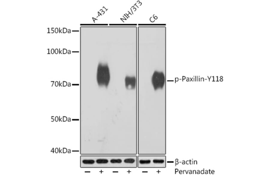 Western Blot - Anti-Paxillin (phospho Tyr118) Antibody [ARC1696] (A306251) - Antibodies.com