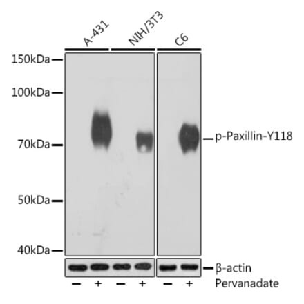 Western Blot - Anti-Paxillin (phospho Tyr118) Antibody [ARC1696] (A306251) - Antibodies.com