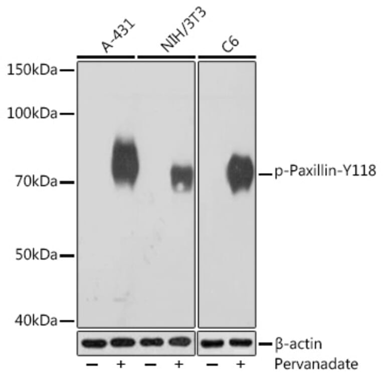 Western Blot - Anti-Paxillin (phospho Tyr118) Antibody [ARC1696] (A306251) - Antibodies.com