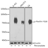 Western Blot - Anti-Paxillin (phospho Tyr118) Antibody [ARC1696] (A306251) - Antibodies.com