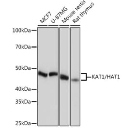 Western Blot - Anti-KAT1 / HAT1 Antibody [ARC1002] (A306252) - Antibodies.com