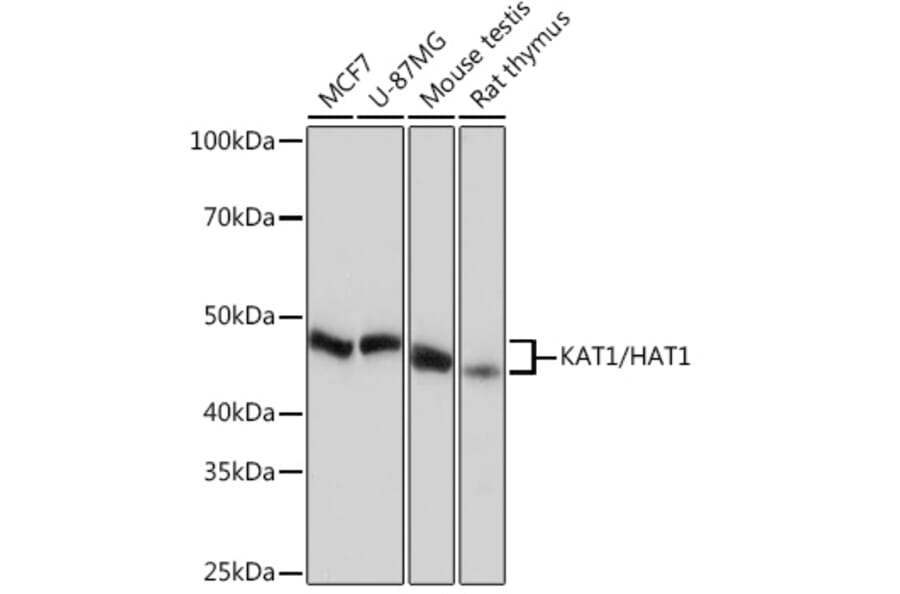 Western Blot - Anti-KAT1/HAT1 Antibody [ARC1002] (A306252) - Antibodies.com
