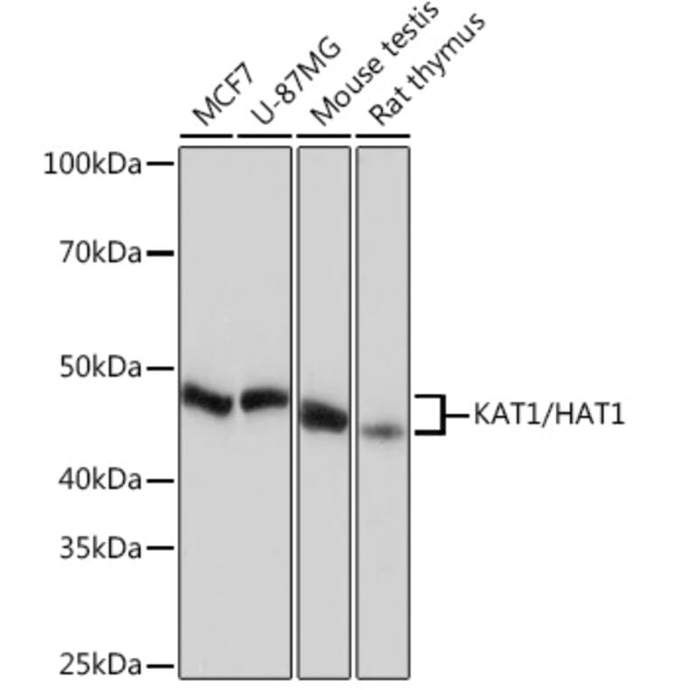 Western Blot - Anti-KAT1/HAT1 Antibody [ARC1002] (A306252) - Antibodies.com