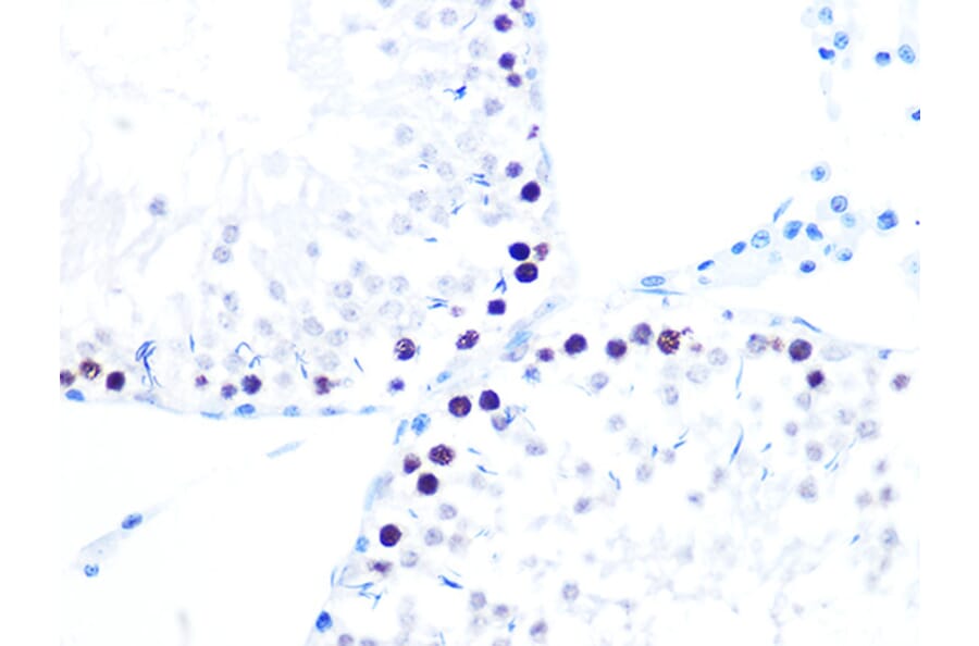 Immunohistochemistry - Anti-KAT1/HAT1 Antibody [ARC1002] (A306252) - Antibodies.com