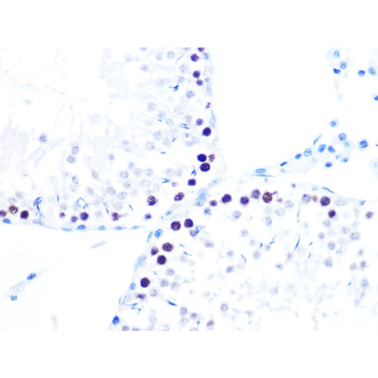 Immunohistochemistry - Anti-KAT1/HAT1 Antibody [ARC1002] (A306252) - Antibodies.com