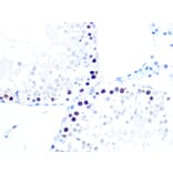 Immunohistochemistry - Anti-KAT1/HAT1 Antibody [ARC1002] (A306252) - Antibodies.com