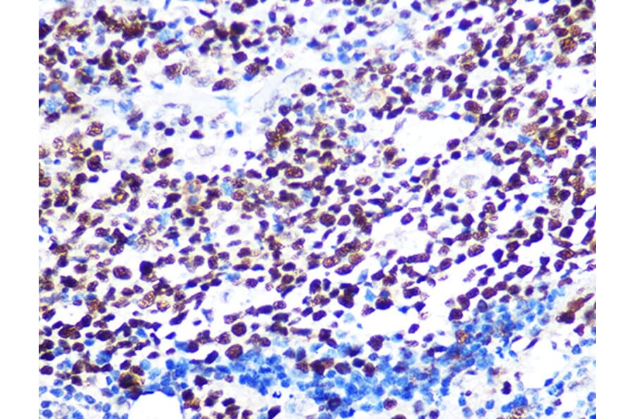 Immunohistochemistry - Anti-KAT1/HAT1 Antibody [ARC1002] (A306252) - Antibodies.com