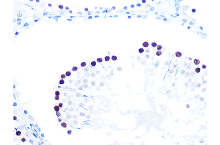 Immunohistochemistry - Anti-KAT1/HAT1 Antibody [ARC1002] (A306252) - Antibodies.com