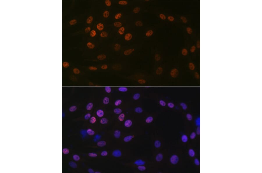 Immunofluorescence - Anti-KAT1/HAT1 Antibody [ARC1002] (A306252) - Antibodies.com